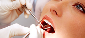 Dişeti hastalıkları nasıl tedavi edilir?